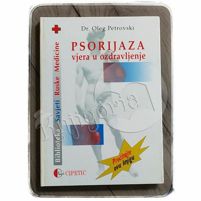 Psorijaza: vjera u ozdravljenje Oleg Petrovski 